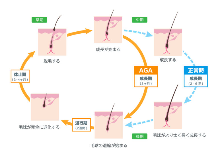 AGAの仕組み