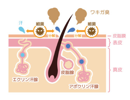 汗・わきの臭い、ワキガについて